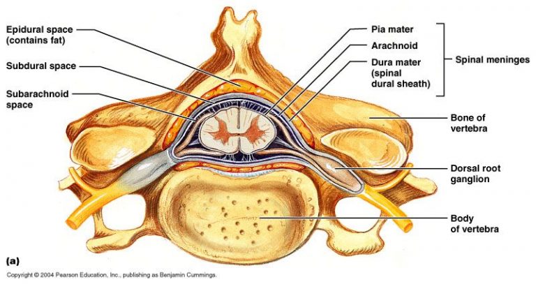 stenosis tulang belakang